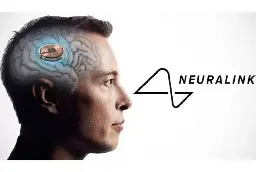 Neuralink a implantat primul cip într-un creier uman
